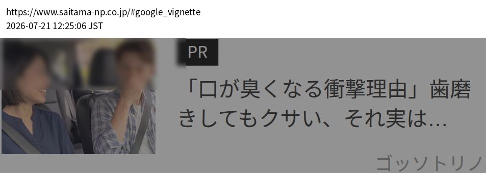 element capture