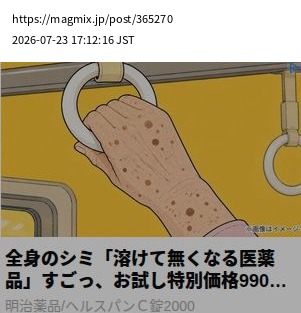 element capture