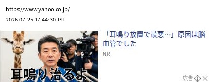 element capture